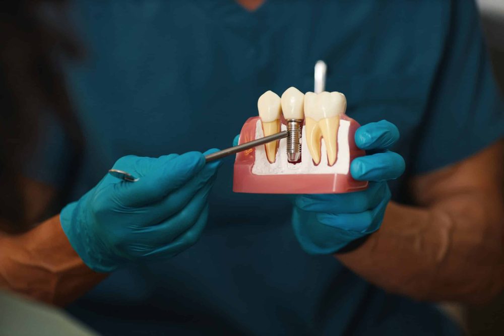 Affordable Dental Implants Knoxville